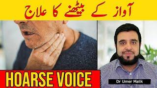 Awaz Ka Baith Jana, Gala Beth Jana Ka Ilaj, Hoarse Voice: Cause & Treatment, Gala Baith Gaya (Urdu)