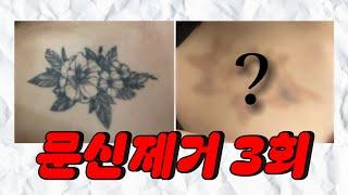 받으면 얼마나 지워질까? | 문신 | 타투 | 제거 | 브이로그