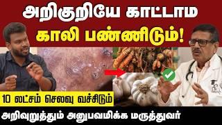 Fatty Liver : கல்லீரல் பற்றி யாருக்கும் தெரியாத அதிர்ச்சி தகவல்ககள்   | Liver | Positivitea