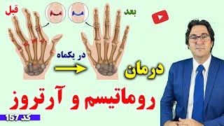 برای درمان آرتروز و روماتیسم چی بخوریم چی نخوریم؟ | با آرتروز انگشتان و روماتیسم مفاصل خداحافظی کن!