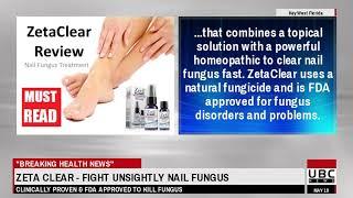 TYLER FOOT CLINIC - Treating Toenail Fungus with Lamisil - TYLER FOOT CLINIC