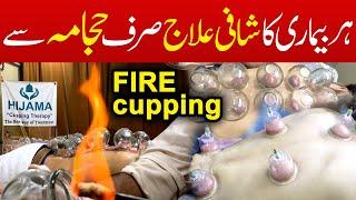 FIRE Cupping Therapy in Karachi | Hijama Cupping | Muscle Fitness