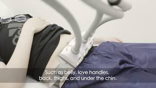 SculpSure for Fat Reduction | Rejuuv Medi Spa | Toronto ON