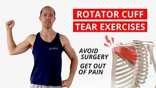 3 Keys to Rehab a Rotator Cuff Tear & AVOID Surgery [NEW EXERCISES]