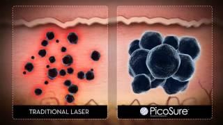 Advanced, effective laser tattoo removal at Washington Inst Derm Laser Surgery