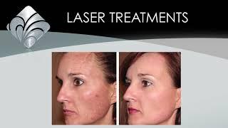 Aesthetic Industry Promotional Video - Laser Treatments