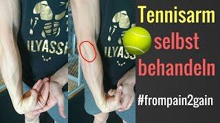 Tennisarm / Tennisellenbogen selbst behandeln - 3 Methoden die funktionieren!│Mischa Kotlyar