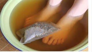 Soak your feet in this for 20 minutes and get rid of your biggest problem!