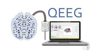 QEEG Explained - How Does A QEEG Brain Scan Work?