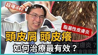 頭皮屑、頭皮癢、脂漏性皮膚炎好困擾，如何治療效果最好？抗屑洗髮精可以每天用嗎？皮膚科林政賢醫師告訴你這樣抗屑最有效！