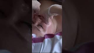 Буккальная фаза массажа лица