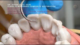 Class III composite restoration (1) –Maxillary central incisor (#11) moderate to large - Arabic عربي