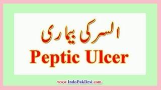 Peptic Ulcer Disease In Urdu/Hindi Dr. Rizwan