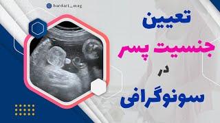 تعیین جنسیت پسر در سونوگرافی      baby boy in ultrasound