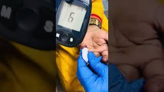Sugar test | Random Blood sugar test #sugar #reels #diabetes #share #shorts #nurse #world #feed