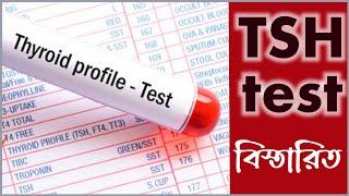 Tsh test report bangla | থাইরয়েড হরমোন টেস্ট খরচ কতো