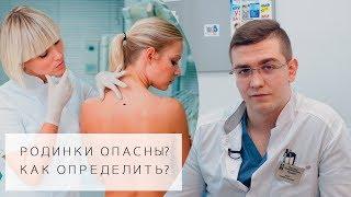 РОДИНКИ ОПАСНЫ? | 5 Простых способов определения | Какие родинки опасны?