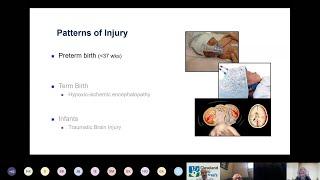 Preterm Birth Struggles & Physician Interventions