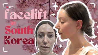 Why go to Korea for a Facelift? - 2024 id Model Rachel's Plastic Surgery Story