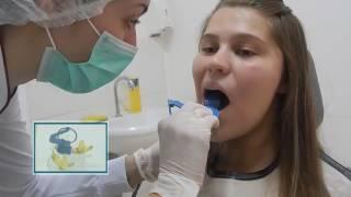 Técnicas radiográficas: Periapical com uso do posicionador e Interproximal