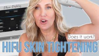 HIFU Skin Tightening - Does it Work? #hifutreatment