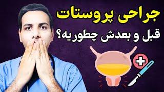 ناگفته‌های جراحی پروستات | Prostatectomy