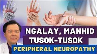 Ngalay, Manhid, Tusok-Tusok: Peripheral Neuropathy (Repost Video)