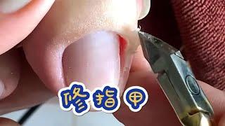 抠指甲的抠师傅##解压视频 #强迫症看了很享受 #指甲修复