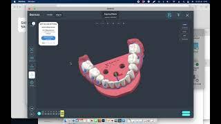 Automatic clear aligner trimming