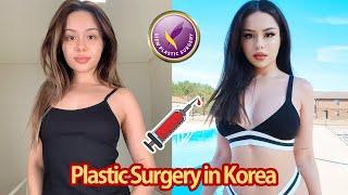 ●View Plastic Surgery● Look Beautiful, Feel Beautiful