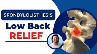 Spondylolisthesis Back Pain Relief: Exercises and Adjustments