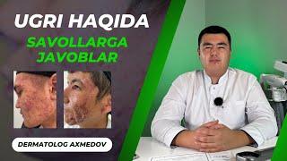 UGRI HAQIDA ENG MUHIM SAVOLLARGA JAVOBLAR