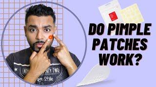 Do Pimple Patches Really Work?? // Mimo The Skinthusiast