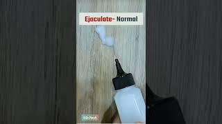 MALE DISCHARGE. #Male discharge #Ejaculation #Semen #shorts