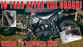 Motorcycle Crash | 10 Years on & What It Taught Me!