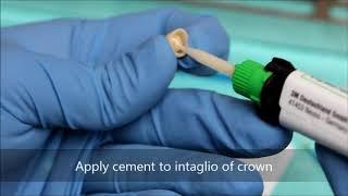 Bonding a zirconia crown