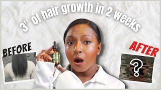 10,000 mcg Biotin for massive hair growth | BEFORE & AFTER | 3+ INCHES under a MONTH