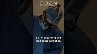 Facelift/Necklift Revision Surgery | Eden Plastic Surgery: Ali Charafeddine, MD