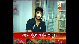 A student of Kolkata Medical College injured as ceiling fan of hostel falls, more danger a