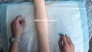 How To Puncture The Arm To Avoid Blowing A Vein By Intravenousqueen