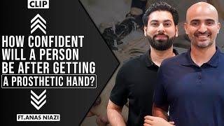 How confident will a person be after getting a prosthetic hand?| Faizan Syed | Anas Niazi | Clip