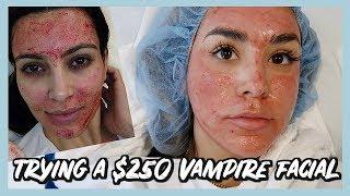 TRYING THE KIM KARDASHIAN VAMPIRE FACIAL? PRP TREATMENT
