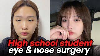 Using double eyelid tapes will be a problem for eyelid surgery? HIght schooler eye&nose surgery