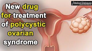 New drug for treatment of polycystic ovarian syndrome