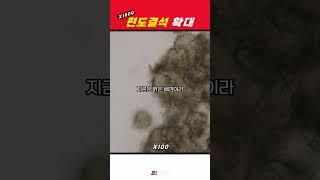 치외법권 지역에서 온 편도결석을 확대하면?