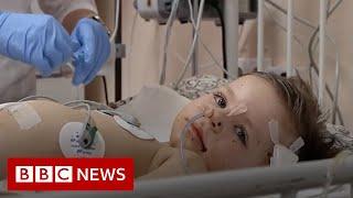 The child victims of Russia’s war in Ukraine - BBC News