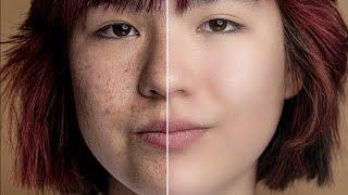 EASY PROFESSIONAL SKIN RETOUCH IN PHOTOSHOP - SMOOTH SKIN