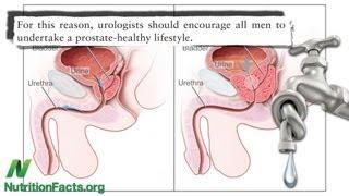 Prostate vs. Plants