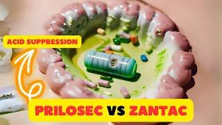 Prilosec vs Zantac: The Battle for Acid Suppression