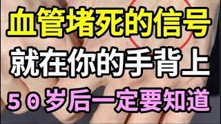 手背出现一个信号，提示你心脏血管马上就要堵死了！特别是50岁以后的人，一定要重视！【家庭大医生】